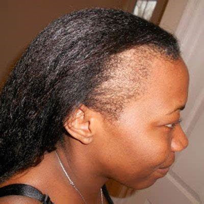 HOW TO PROTECT YOUR EDGES (FRONT HAIR)